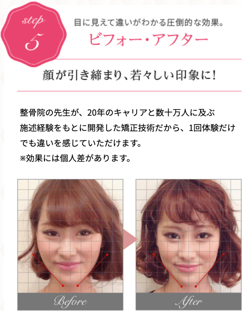 公式】Speed小顔（スピード小顔） | 多数のモデル・芸能人さんも通う小