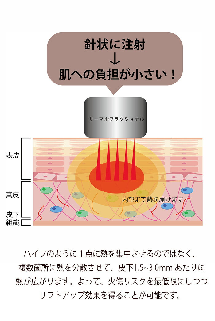 楽天市場】業務用美容機器 サーマルフラクショナル : moise 楽天市場店