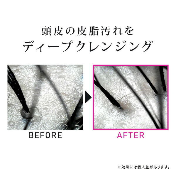 楽天市場】Nano Beauty Revolution(ナノビューティーレボリューション