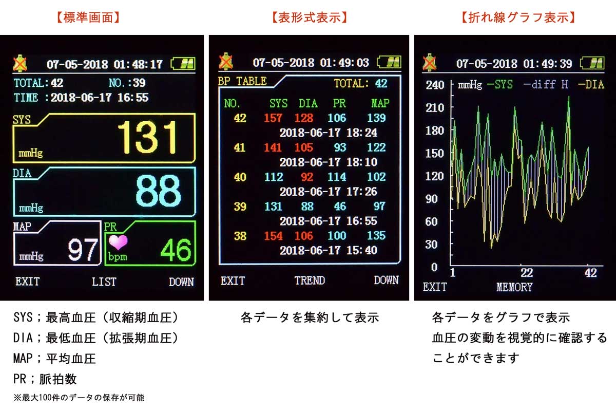 エルデペット用 ERDE PES-1700 血圧計 デジタル表示 Amazon | エルデ