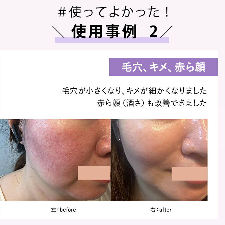 プラズマエアシャワー DENSHINDO UN01 オマケのポーチ付き 商品詳細