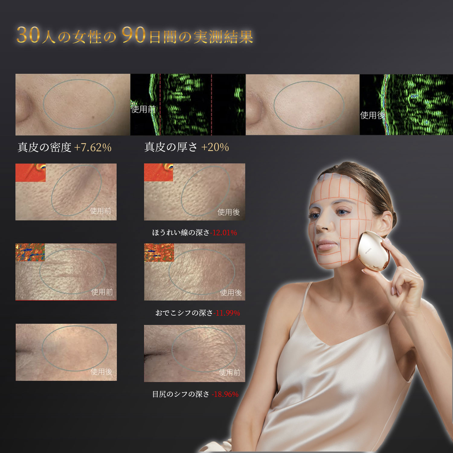 楽天市場】【ミラープレゼント中】AMIRO 公式 最新 RF美顔器 美顔