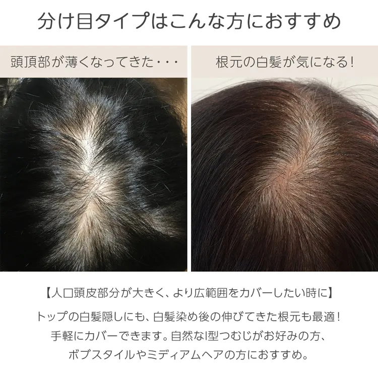 マシンメイド人毛100%トップヘアピース 分け目タイプ（ポイント/医療用