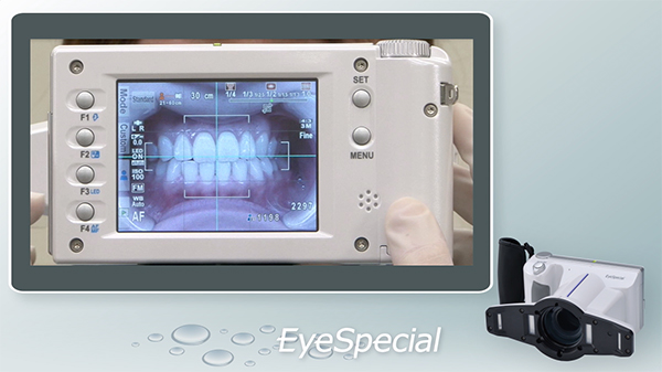 EyeSpecial – Shofu USA