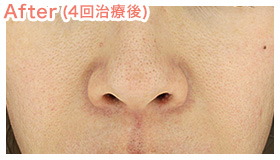 エレクトロポレーション | 自由が丘ロジエクリニック