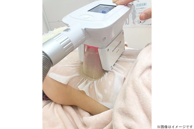 脂肪冷却クーリング2カップ