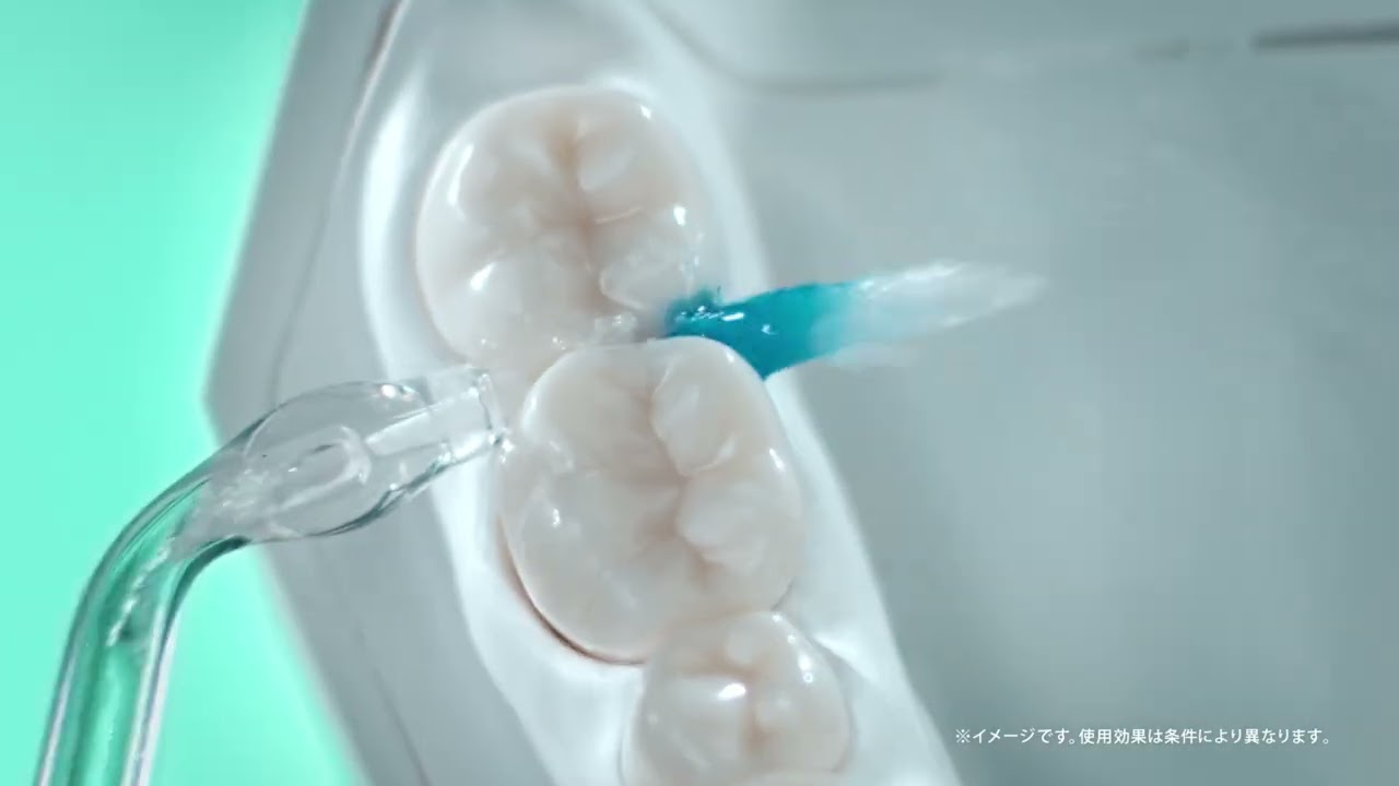 ジェットウォッシャー ドルツ EW-DJ55 歯ブラシでは取りきれない篇30秒