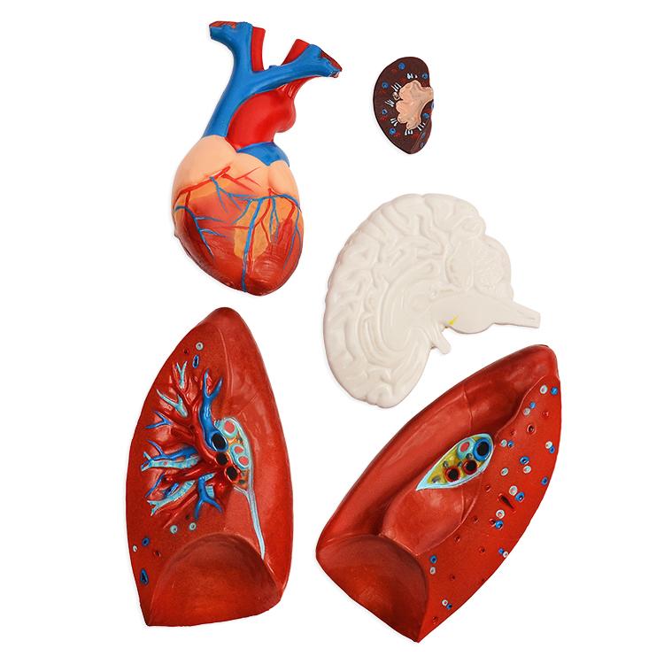 内蔵模型 人体模型85cm 男性 GX-201パーツ取り外し可 JK-2994Y : 株式