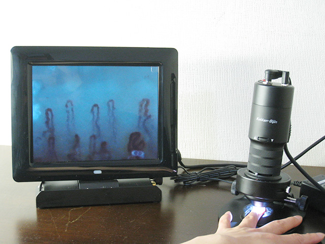 毛細血管スコープSC-10 – あっと株式会社