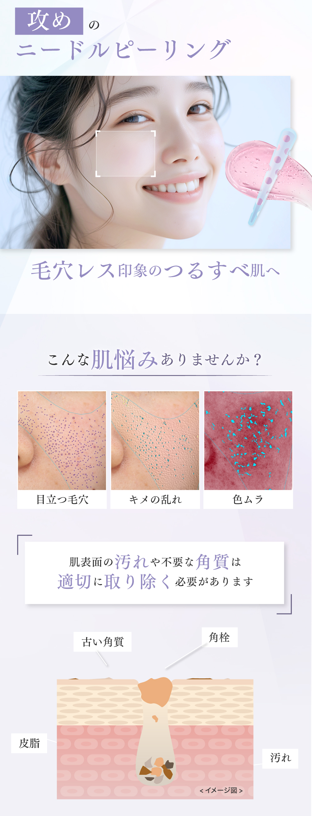 fractional CC 【公式】フラクショナルCC ニードルピーリングジェル