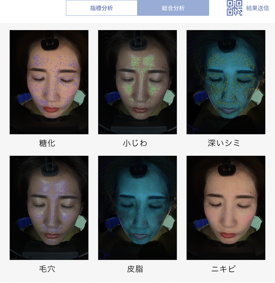 アクサフェイス 肌診断 AX Face 美品 アクサフェイス 肌診断 AX Face 美品